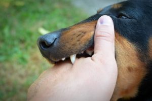 Your Guide to Nevada Dog Bite Injury Cases