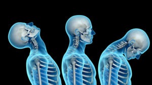 what-are-the-dangers-of-whiplash-after-a-car-accident