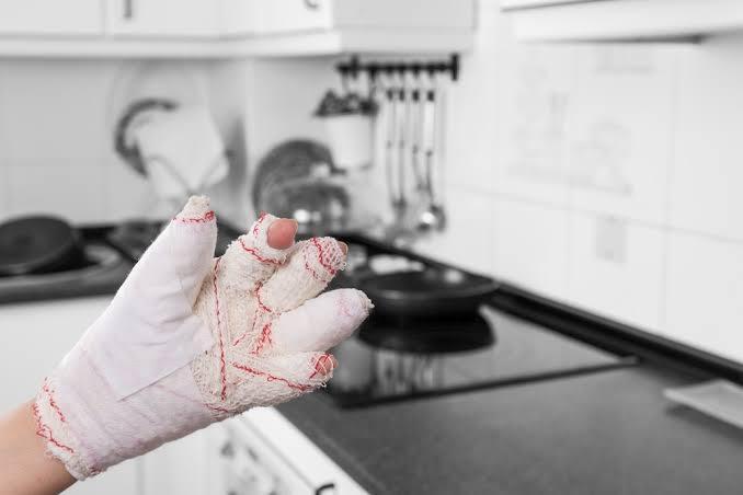 Pressure Cooker Injuries