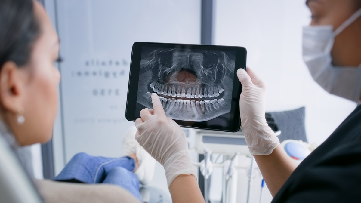 dentist-showing-x-ray-to-patient