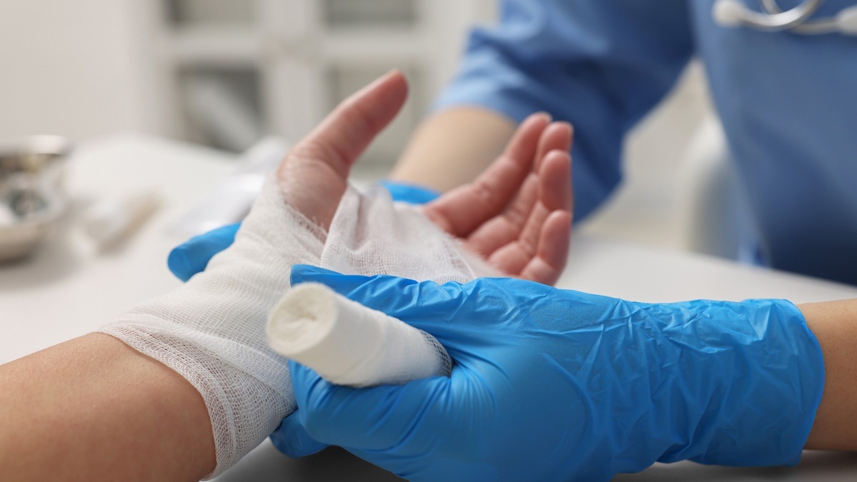 nurse-putting-dressing-onto-a-burned-hand