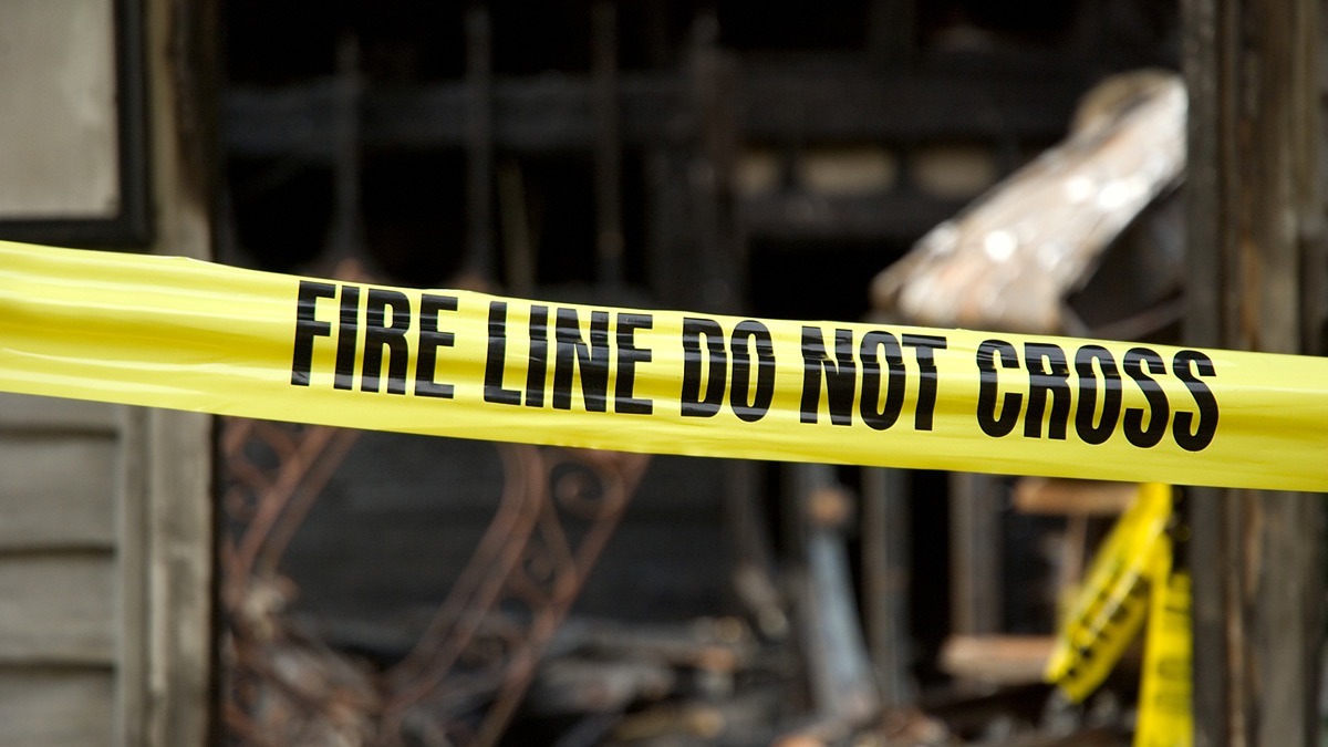 Understanding Long-Term Compensation After a Burn Injury