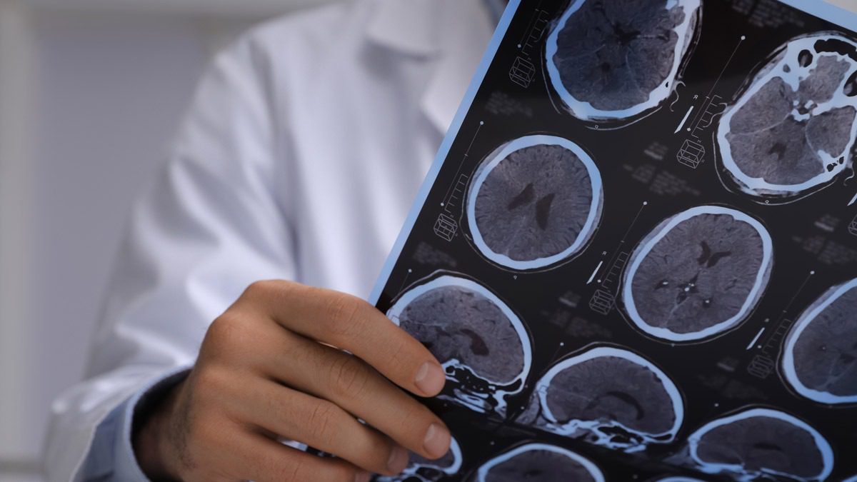 doctor-holding-imaging-scans-of-brain