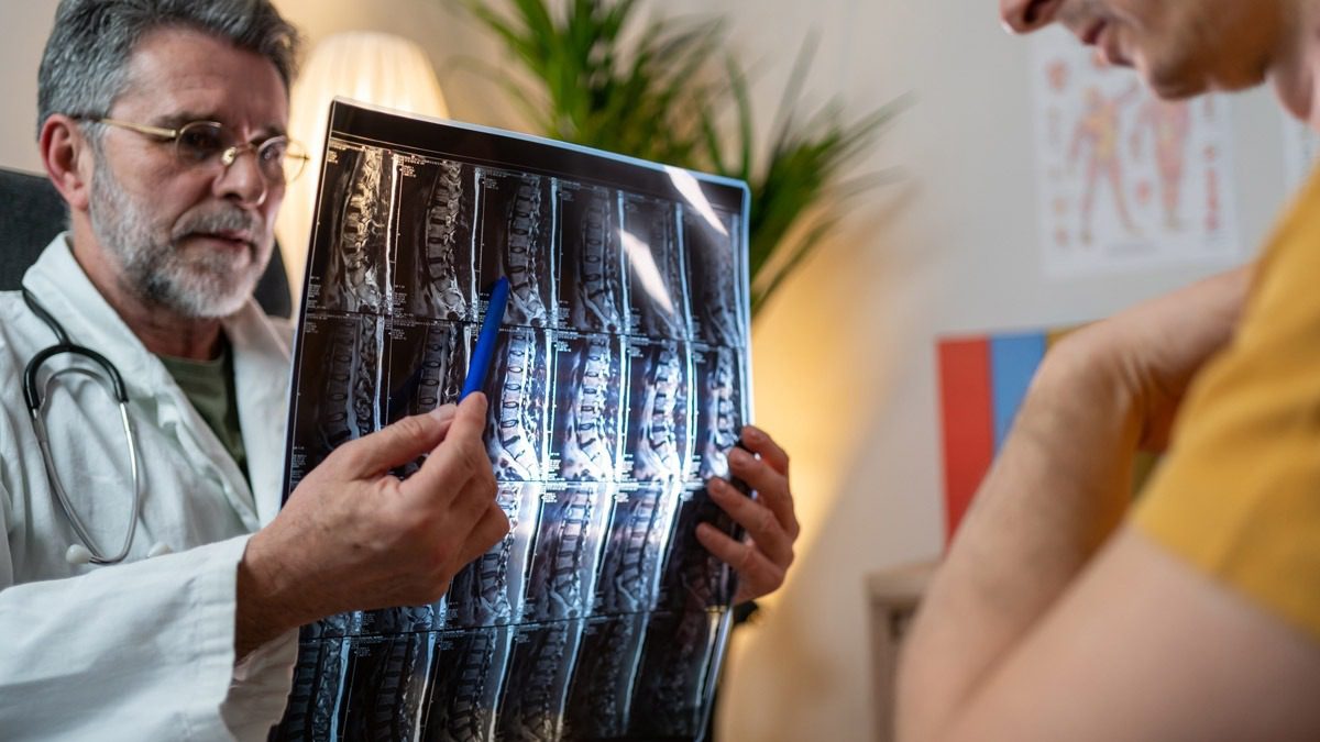 doctor-showing-spinal-x-ray-to-patient