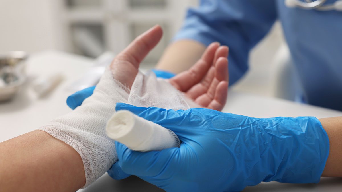 doctor-wrapping-a-patients-burned-hand