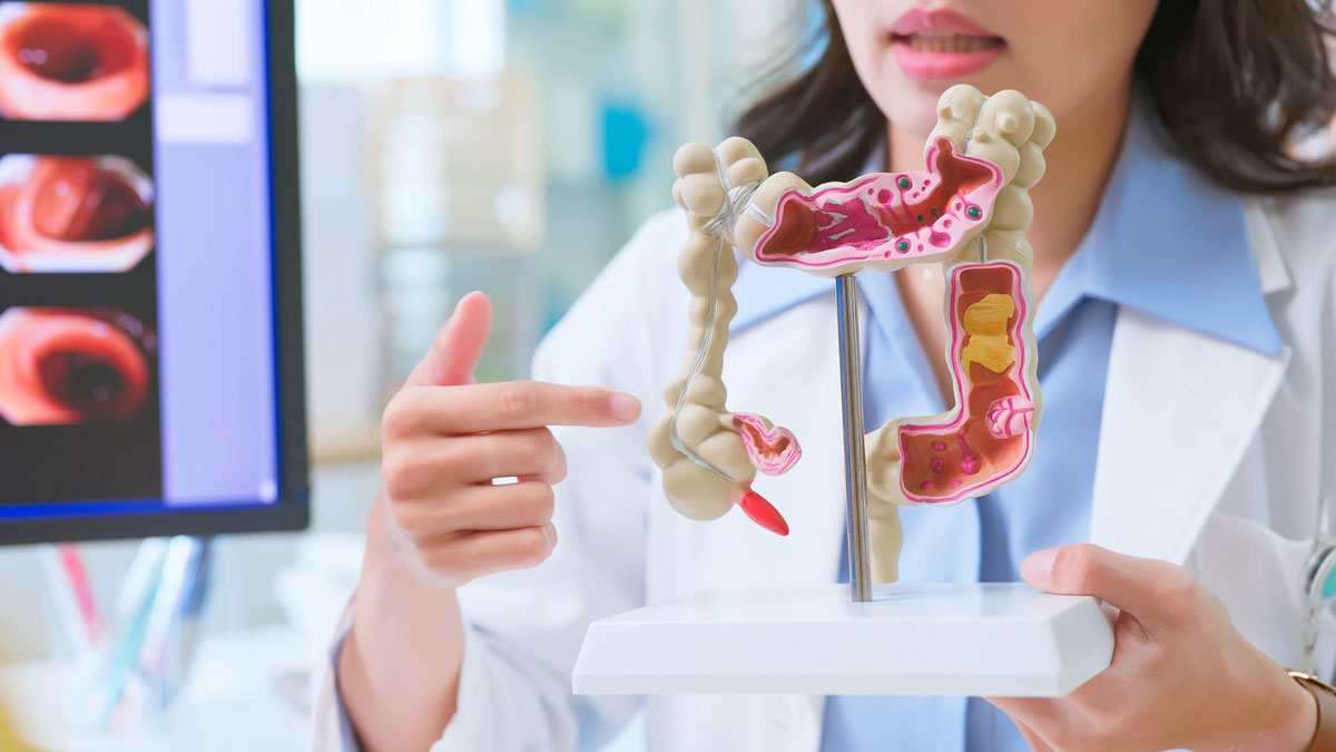 doctor-pointing-to-model-of-colon