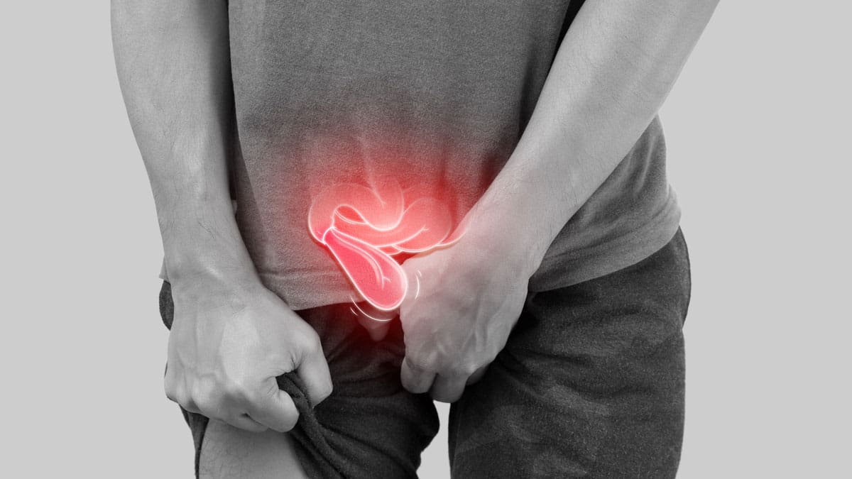 illustration-of-hernia-location-in-male-patient