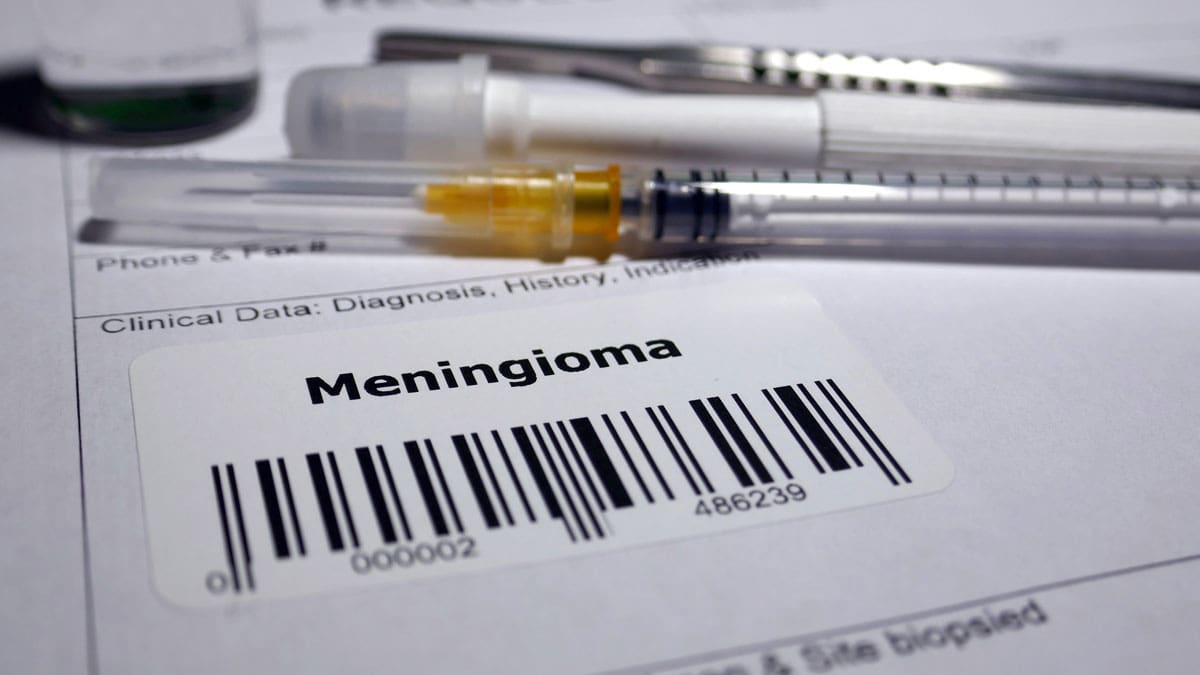 medical-paperwork-with-meningioma-diagnosis