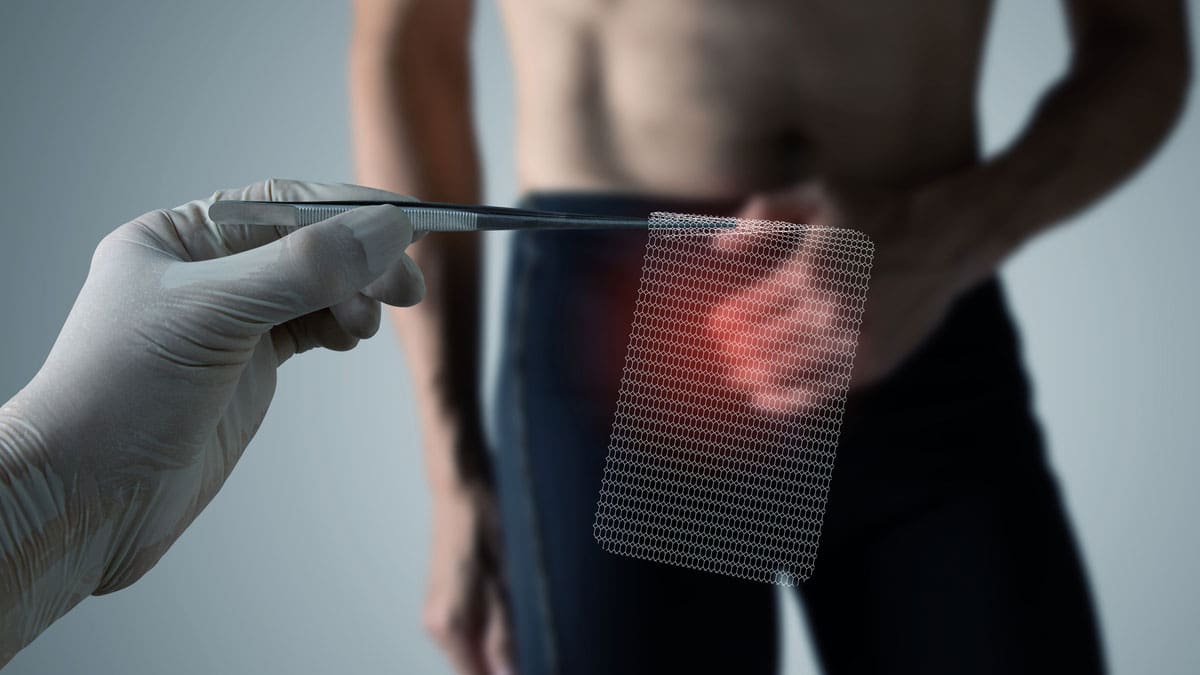 medical-provider-holding-surgical-mesh-in-front-of-male-patient