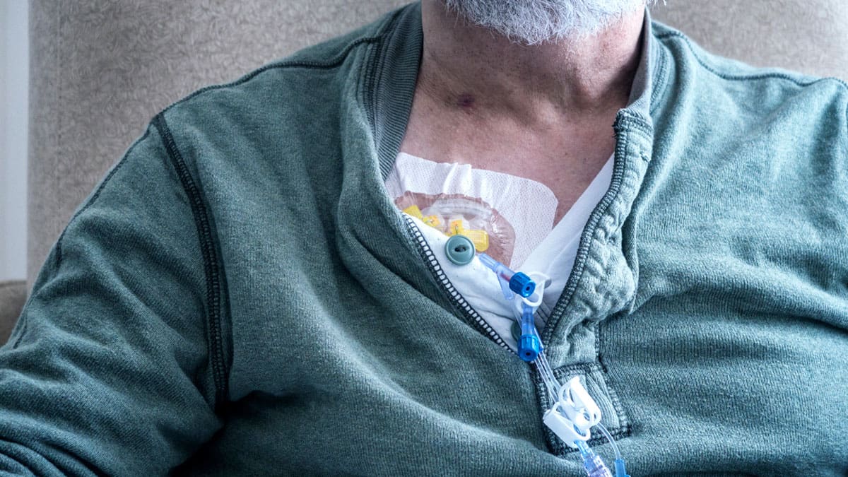 patient-with-port-on-chest