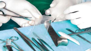 surgical-tools-with-doctor-cutting-surgical-mesh