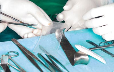 Hernia Mesh Mass Tort Update: Where the Litigation Stands in 2026