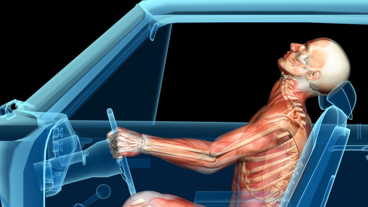 illustration-of-a-body-and-skeleton-in-a-vehicle-during-a-side-impact