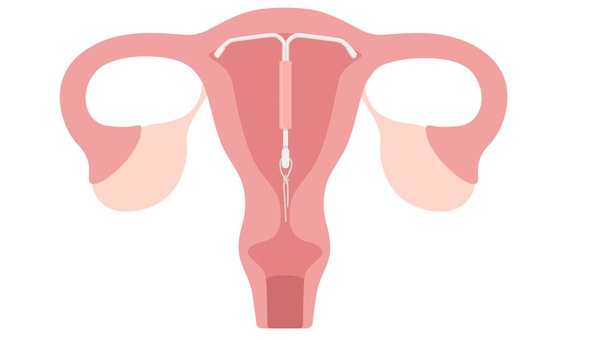 illustration-of-the-uterus-ovaries-and-fallopian-tubes