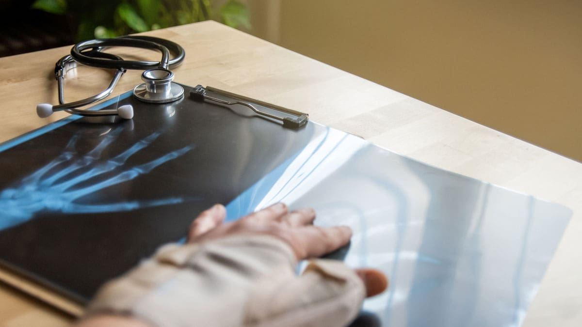 person-reviewing-x-ray-films-on-a-desk