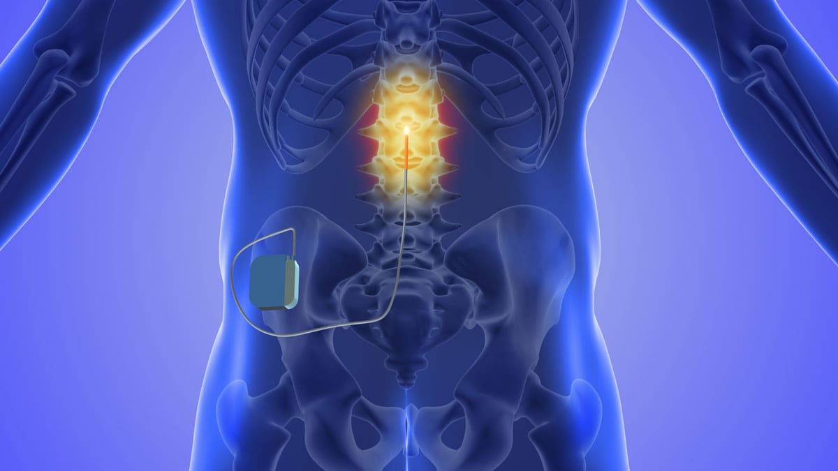 illustration-of-a-torso-with-the-lower-spine-highlighted-in-yellow