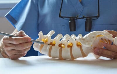 Spinal Cord Stimulator Lawsuits: Overview and Updates
